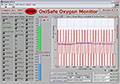 OxiSafe-Oxygen-Safety-Monitor-Software